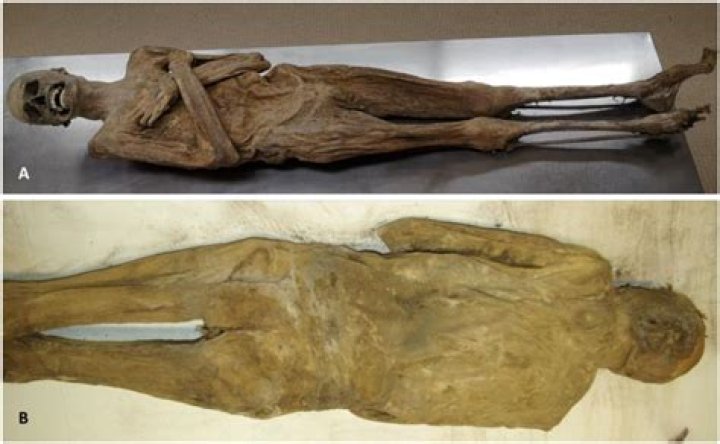 Scientists Baffled By Man Whose Body Mummified In Just 16 Days